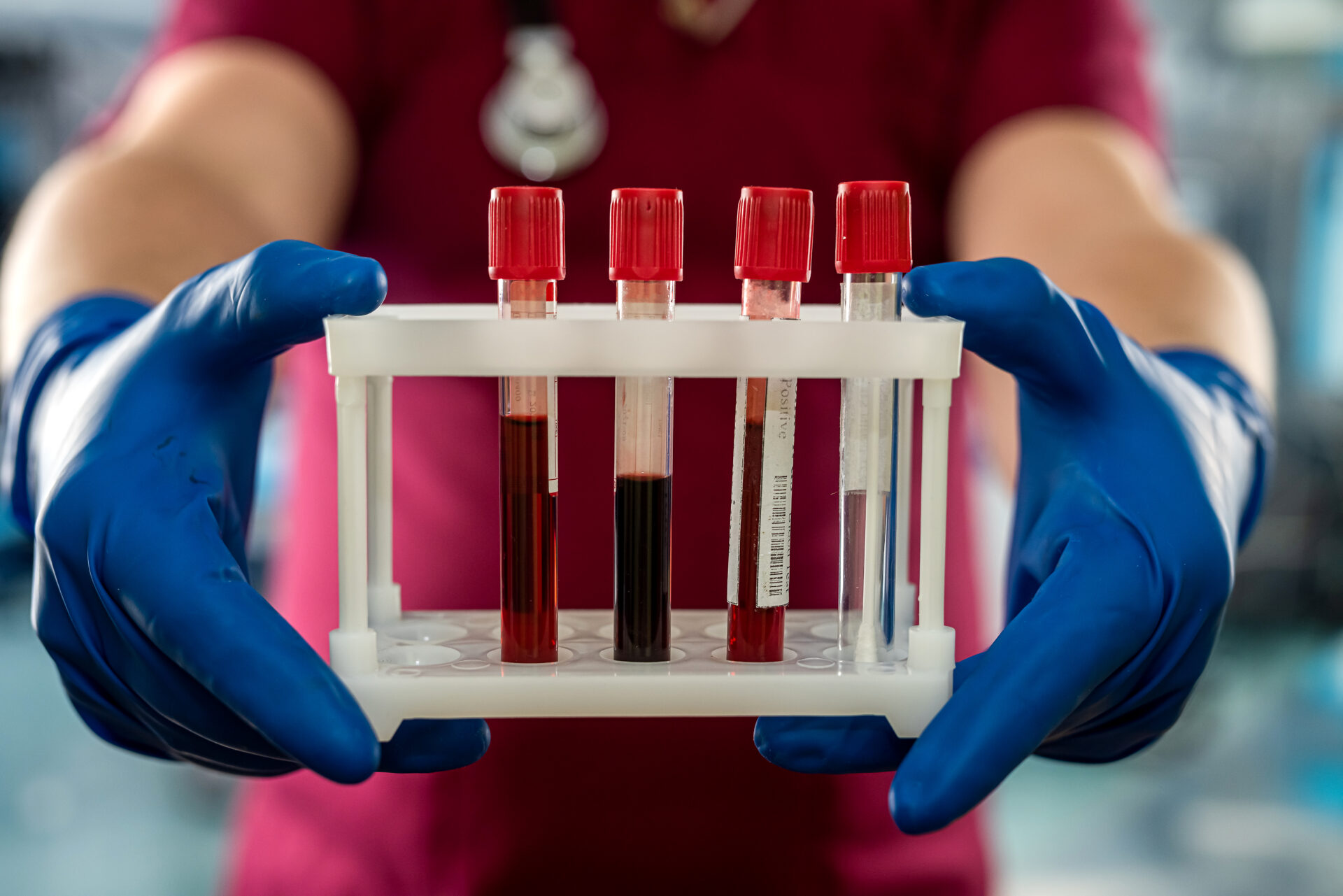 Blood Sample Collection at Home Dr Balaji Hospital